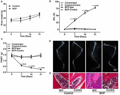 Inhibition of Connexin 43 and Phosphorylated NR2B in Spinal Astrocytes Attenuates Bone Cancer Pain in Mice